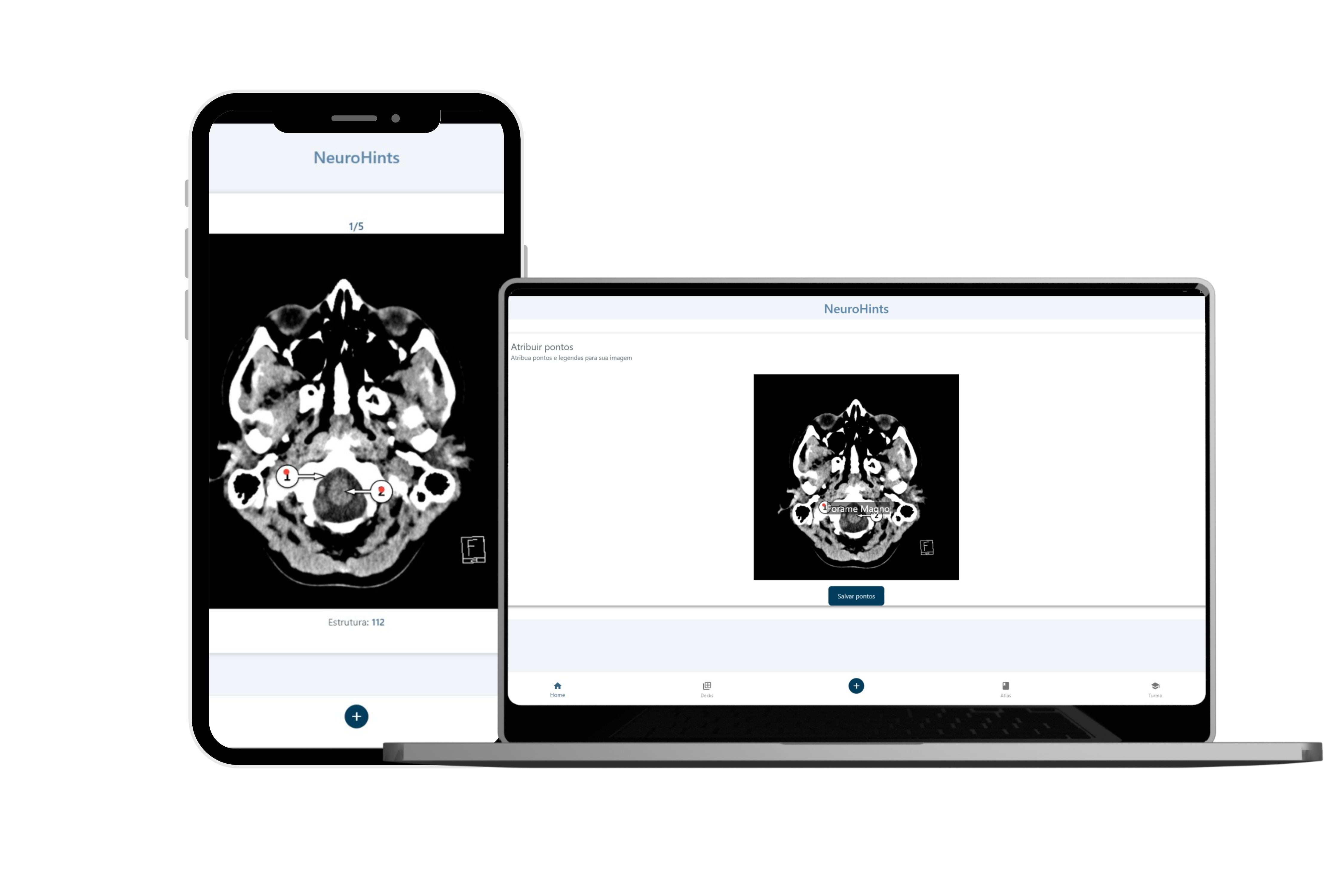 Imagem adicionando pontos numa imagem