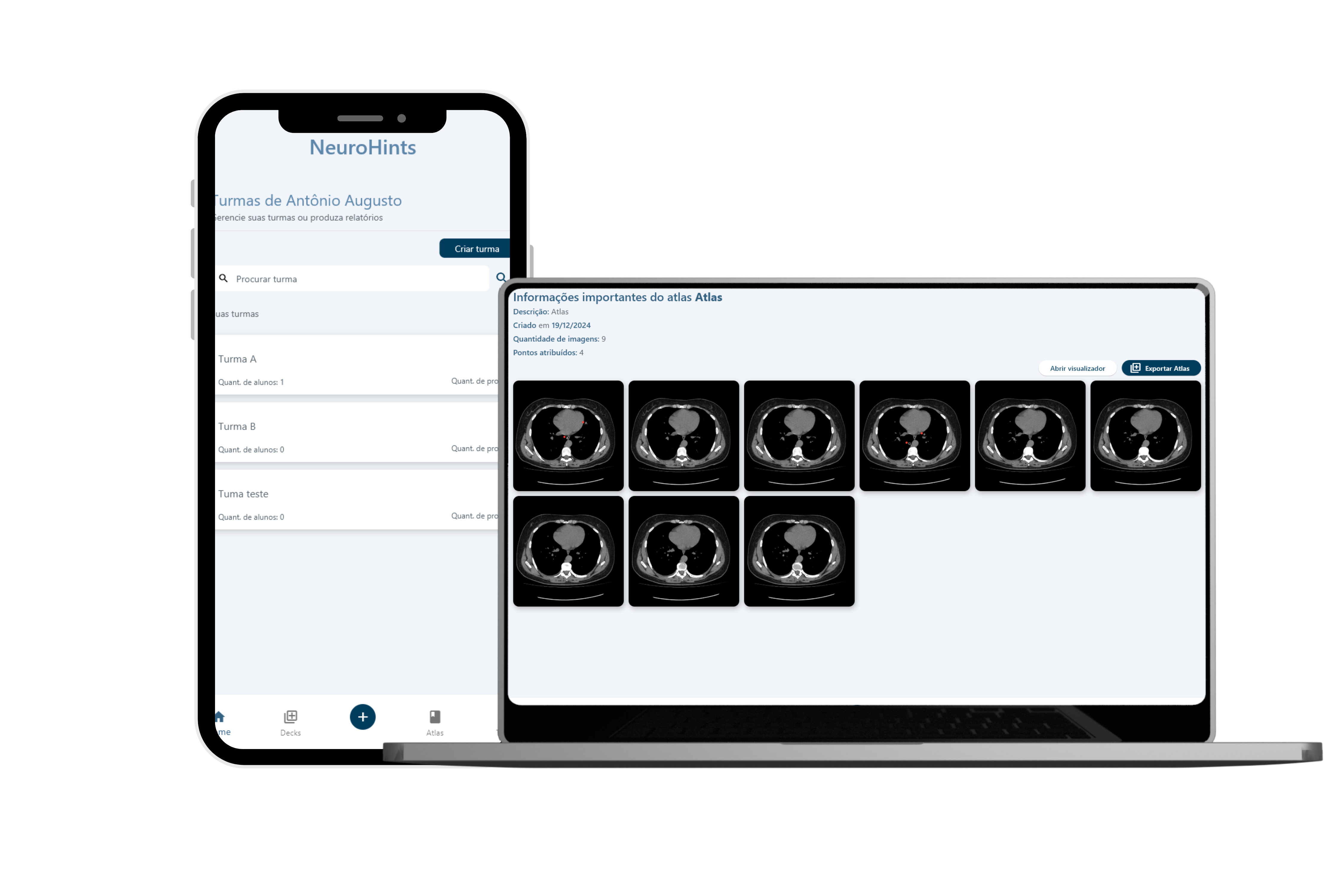 Imagem mostrando o exportar atlas